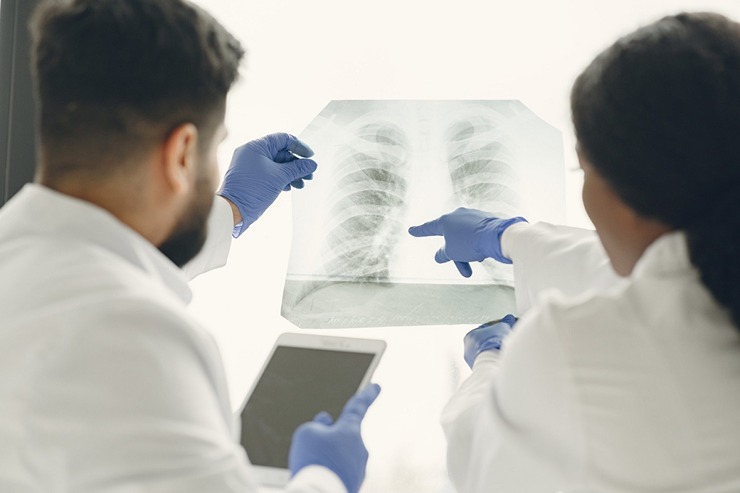 Dossier complet sur l’embolie pulmonaire